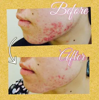 菊地 恵美のエステ・リラクイメージ