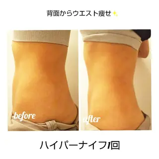 【ニキビ/肌管理】 salon varyのエステ・リラクイメージ