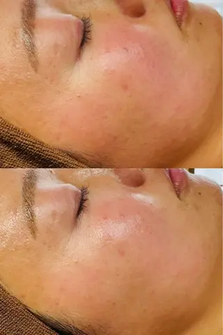 LukeBeauty salonのエステ・リラクイメージ