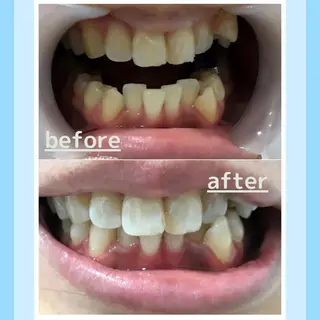 メンズ お手軽ホワイトニングsalon mina所属・武元 奈津美のその他イメージ