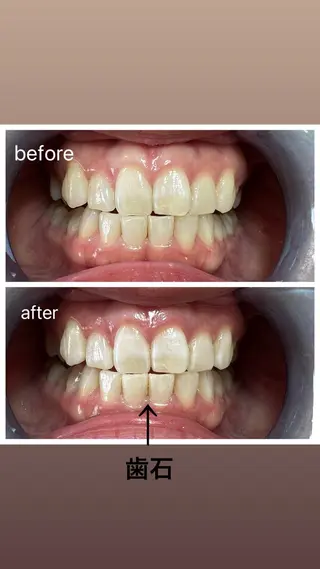 セルフホワイトニング Shineeのエステ・リラクイメージ