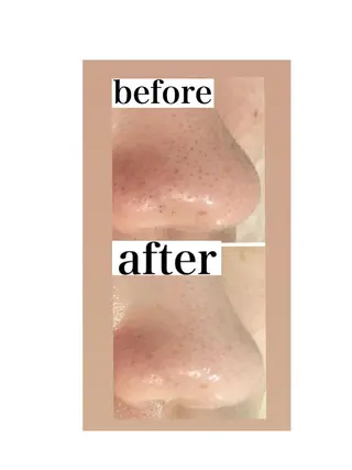 メンズ beauty salonnのエステ・リラクイメージ