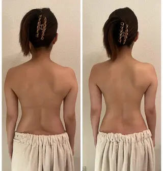 女性ホルモンとバスト 未病ケアサロンのエステ・リラクイメージ