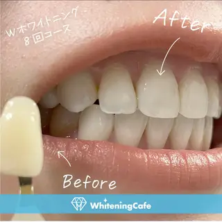 ホワイトニングカフェ神戸元町店所属・ホワイトニングカフェ 神戸元町店のエステ・リラクイメージ