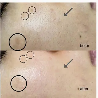 Anacia Beauty Salon所属・美肌脱毛&毛穴専門 Anaciaのエステ・リラクイメージ