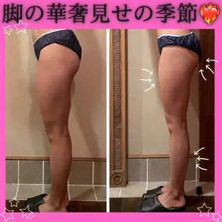 痩身&美肌サロン 堀米✨のエステ・リラクイメージ
