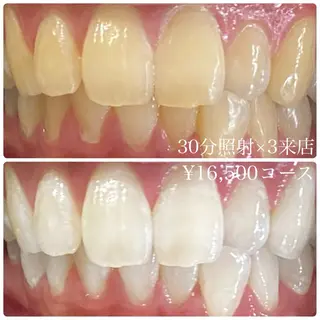 メンズ ホワイトニングルーム 川崎店所属・ホワイトニング ルーム 川崎店のその他イメージ