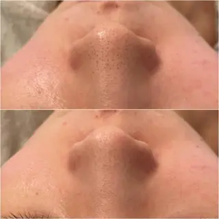 ✨美肌水光✨ アトリエリュバンのエステ・リラクイメージ