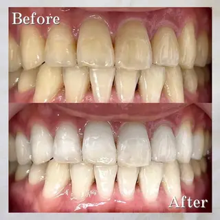 LBSホワイトニング 🌐岡山店のその他イメージ