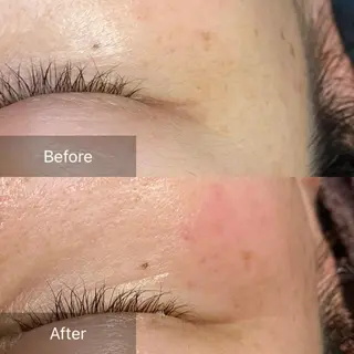 産毛専門店 Bittoのエステ・リラクイメージ