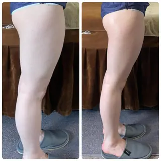 FLEUR大阪・整体 ・ハイフ・痩身・小顔のエステ・リラクイメージ