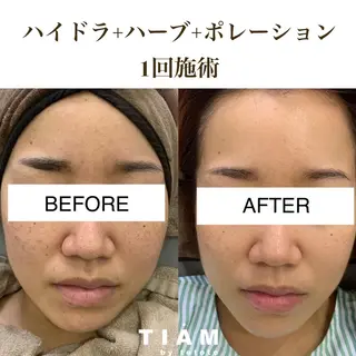 美肌サロンTIAM by tetoteのエステ・リラクイメージ