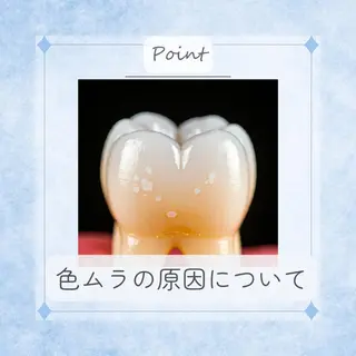 ミディアム パーマ ホワイトニングサロン nico西葛西店のその他イメージ