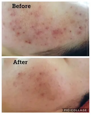 FLEUR大阪・美容 整体・痩身・小顔のエステ・リラクイメージ