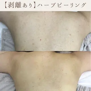 肌質改善サロン renew所属・肌質改善サロン renew/ｳｴｷのエステ・リラクイメージ