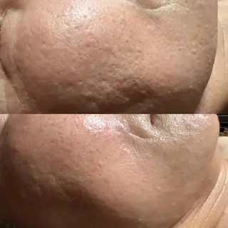 lymph care 'Welnəsのエステ・リラクイメージ