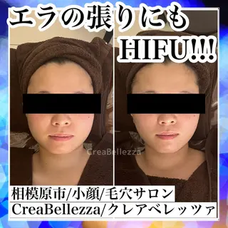 小顔/毛穴サロン クレアベレッツァのエステ・リラクイメージ