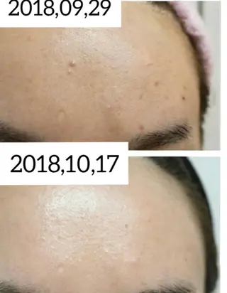 ☺ハーブピール💕 ソフィアカロン💖のエステ・リラクイメージ