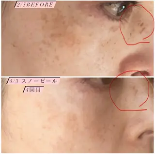 フィユ所属・〚博多〛フィユ 水江のマツエク・マツパデザイン