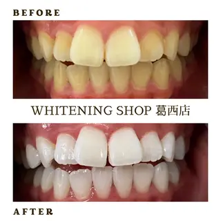 メンズ ホワイトニング ショップ葛西店のその他イメージ