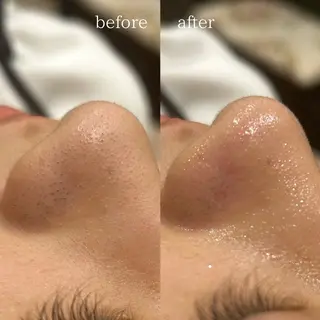 💎美容革命ラボ💎 大名店のエステ・リラクイメージ