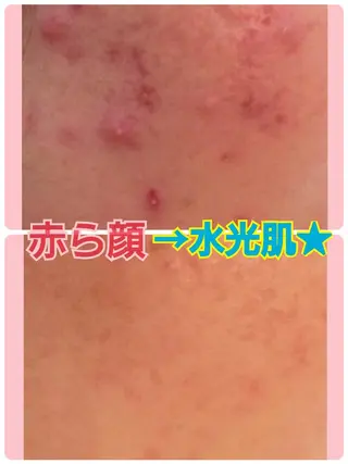 ハーブピーリング 専門店Kikkaのエステ・リラクイメージ