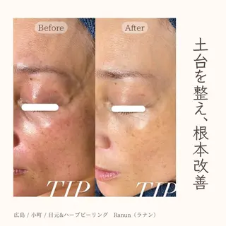 Mau beauty salon所属・Mau (マウ)のエステ・リラクイメージ