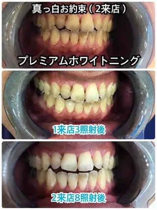 セルフホワイトニングビューティー三川店所属・中村 江梨香のその他イメージ