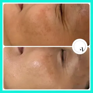 プライベートサロン リレア･ラカのエステ・リラクイメージ