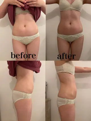 腸活サポート みなみののエステ・リラクイメージ