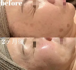 鍼灸サロン　MARINOTE所属・鍼灸サロン MARINOTEのエステ・リラクイメージ