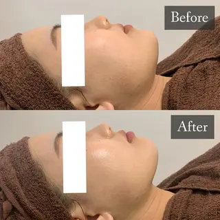 脱毛専門サロン BELFINE恵比寿のエステ・リラクイメージ