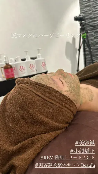 美容鍼灸整体サロンBeauJu所属・小顔矯/美容鍼/鍼灸 BeauJuのその他イメージ