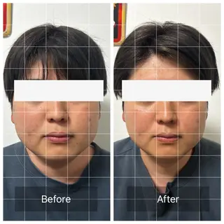 メンズ エマニエル USAのエステ・リラクイメージ