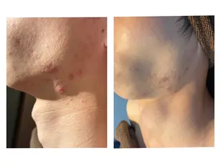 NAZ  (ナーズ)のエステ・リラクイメージ