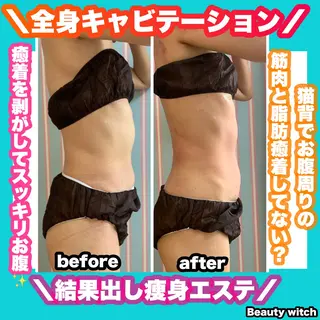 痩身/脱毛/ネイル HARUKAのエステ・リラクイメージ