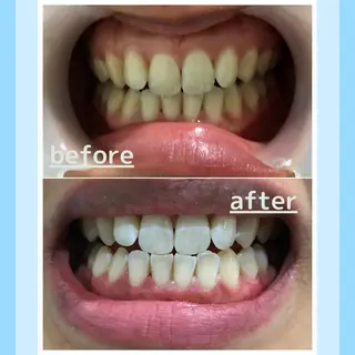 メンズ お手軽ホワイトニングsalon mina所属・武元 奈津美のその他イメージ