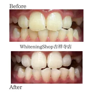 ホワイトニング ショップ吉祥寺店のエステ・リラクイメージ