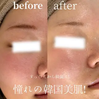 abbellina×UNO出雲塩冶店《ウノ》所属・フェイシャルエステ 🫧琉衣のエステ・リラクイメージ