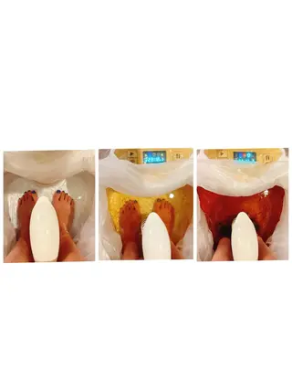 耳ツボ/体質改善/ 温活La mer月島のその他イメージ