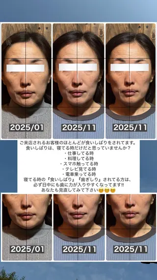 💎後悔させない小顔 矯正💎イトヤマ🌱のエステ・リラクイメージ