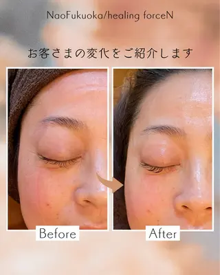 Nao Fukuoka/healingforceN所属・野中 康子のエステ・リラクイメージ