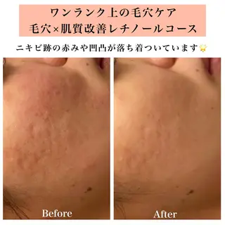 Bellesthe (ベルエステ)のエステ・リラクイメージ