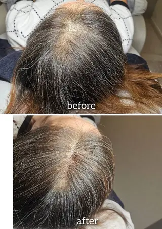 歯科提携セルフダック 宇都宮駒生店のエステ・リラクイメージ