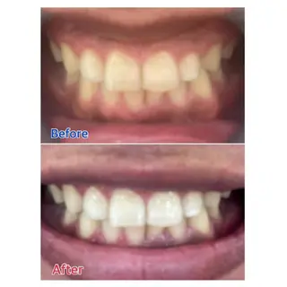 M渋谷店所属・Ｍ渋谷 ホワイトニングのエステ・リラクイメージ