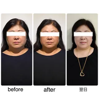 セミロング カラー ネイル 小顔矯正専門サロンジュマリ所属・町田 淳子のエステ・リラクイメージ