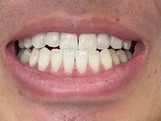 セルフホワイトニングサロン　ラヴィアン所属・ホワイトニングサロン La vie enのその他イメージ