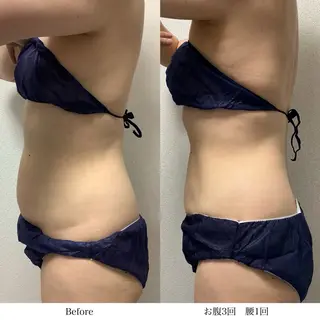 冷却専門店 SLARIのエステ・リラクイメージ