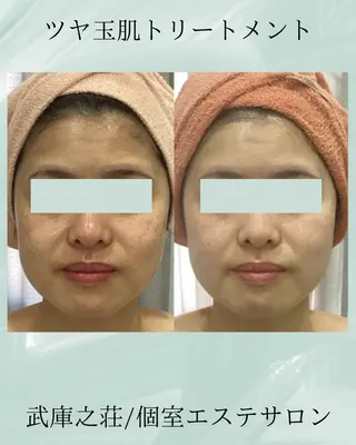 エステ♡Eden Asamiのエステ・リラクイメージ