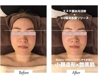 痩身×フェイシャル ブライダル|Linoのエステ・リラクイメージ